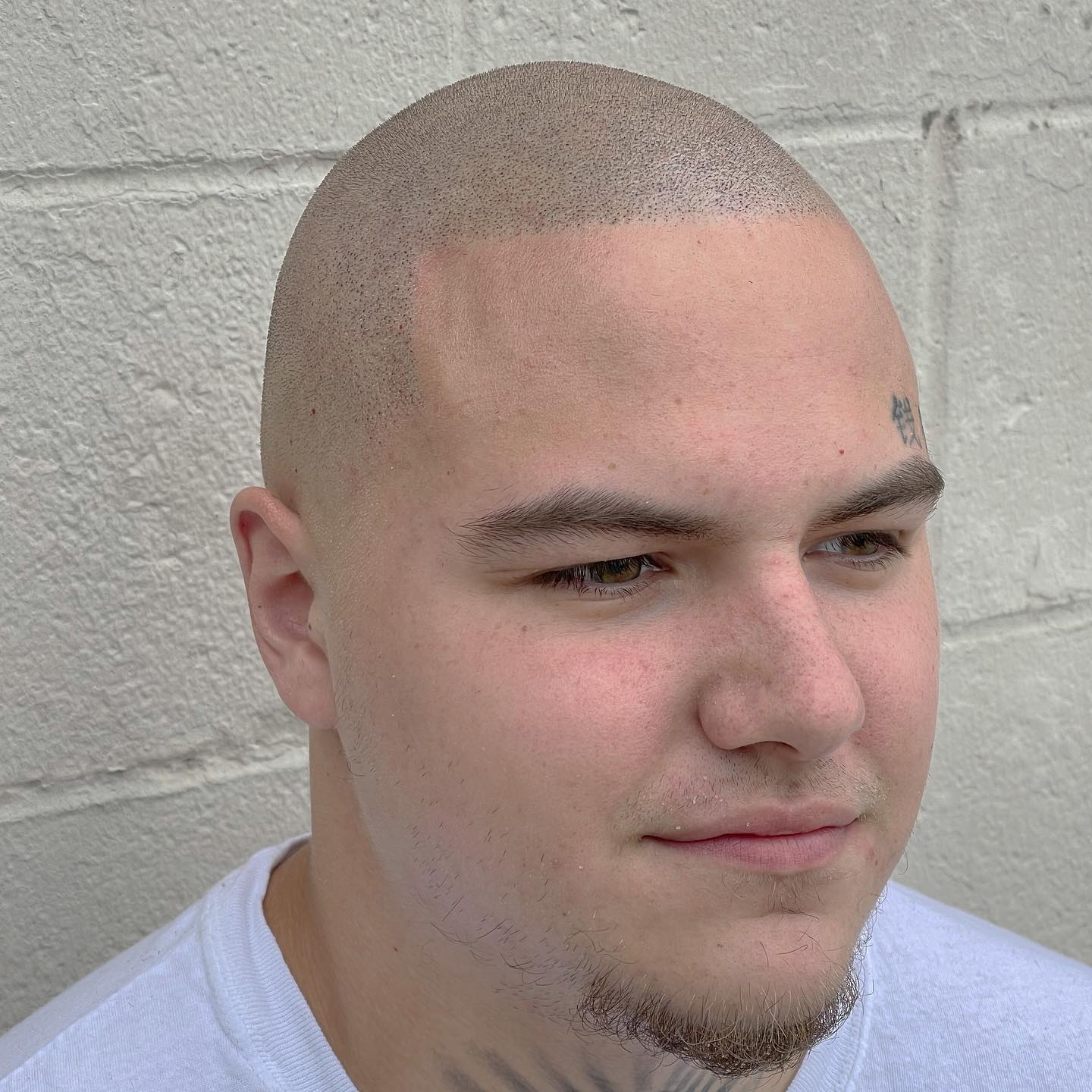 Unlocking the Relationship Between Weight Loss and Hair Health