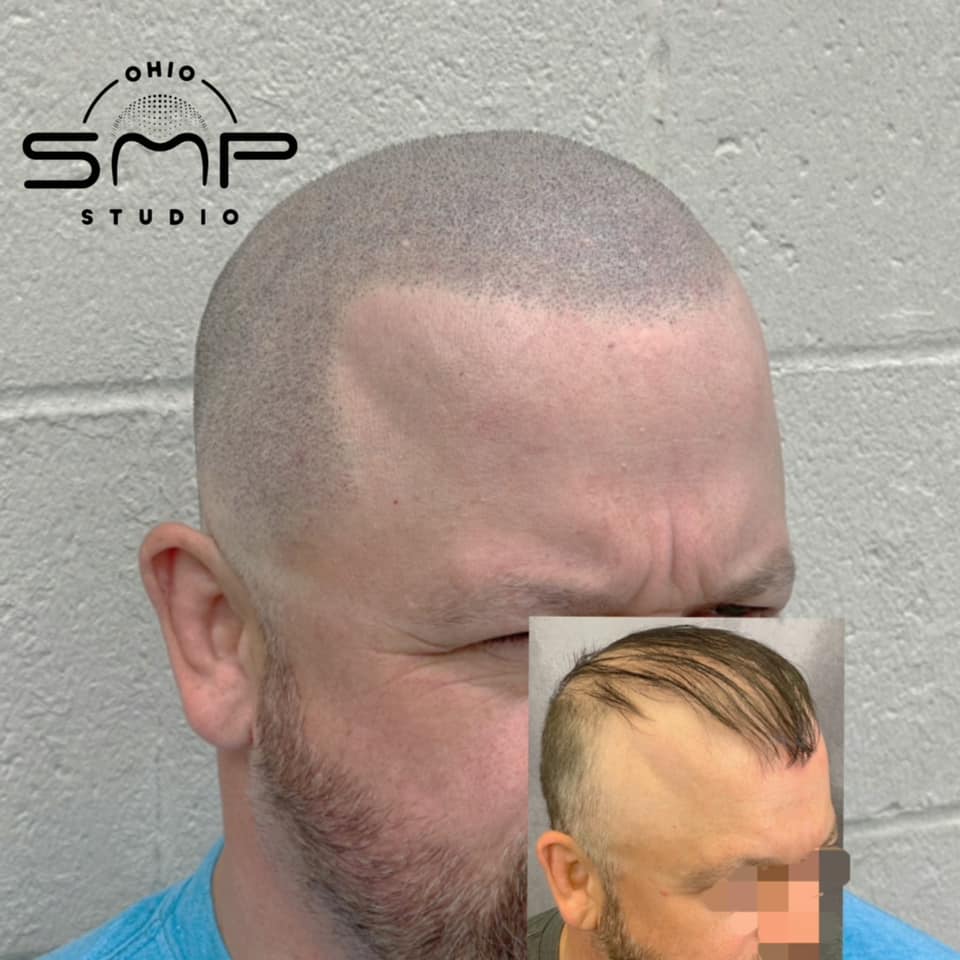 Can Constant HatWearing Lead to Baldness? Unveiling the Truth About