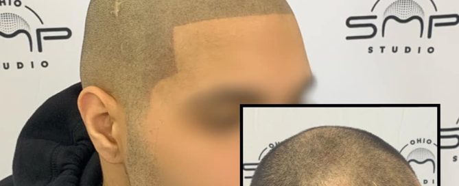 A bottle of biotin supplements next to a strand of hair, illustrating the connection between biotin and hair health.