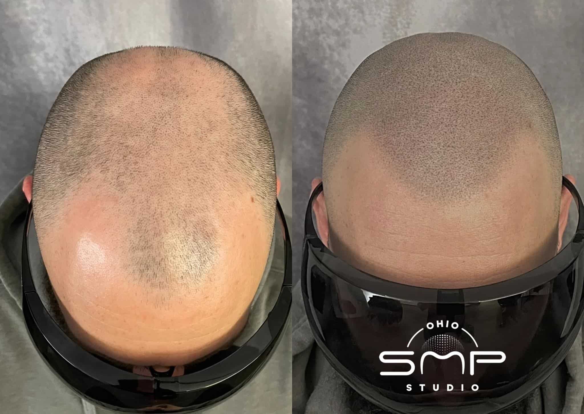 Nourishing Your Hair Through Menopause Essential Nutrients at Ohio SMP